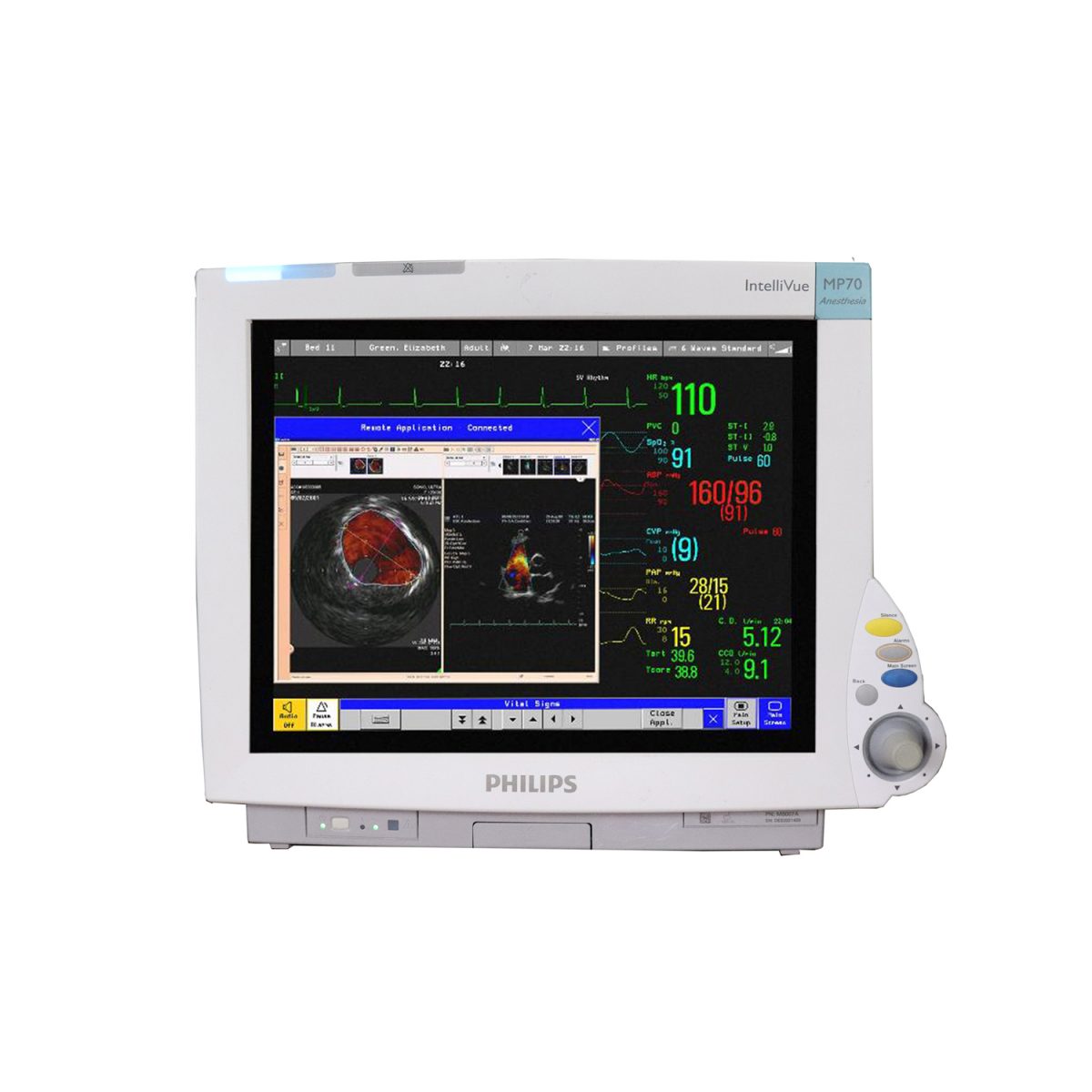 Philips IntelliVue MP70 Monitor Paziente Touchscreen Con Philips X2 - Usato, Buone Condizioni